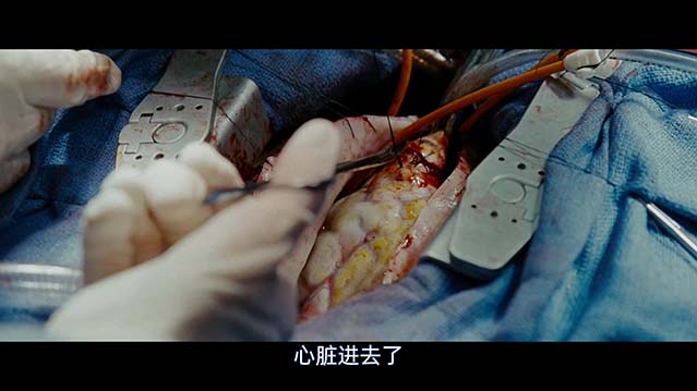 夺命手术-BD1080P-MP4-中文字幕